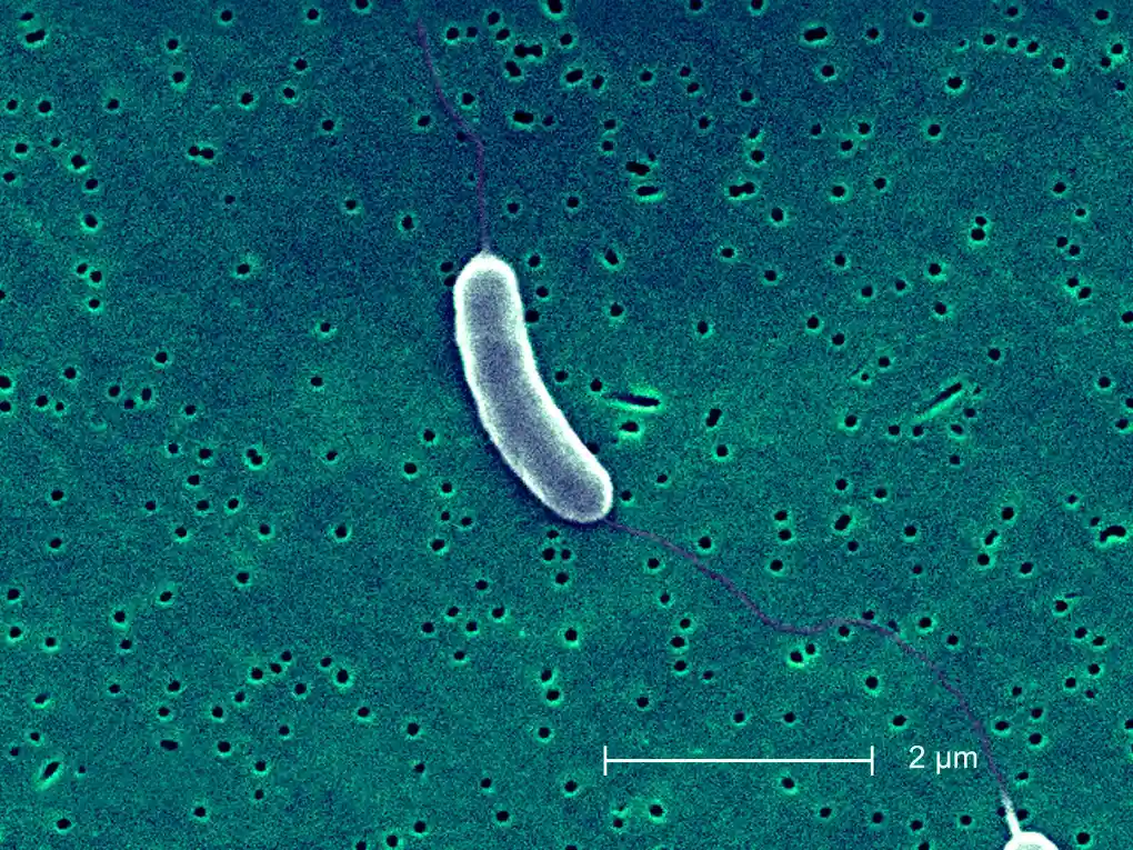 Vibrio vulnificus: Symptoms, Causes, Treatment & Prevention